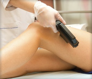 How effective is laser hair removal