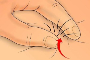 Brazilian waxing-how to eliminate ingrown pubic hair