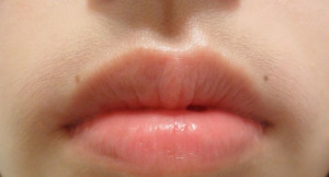 Upper Lip Waxing How to remove your upper lip hair
