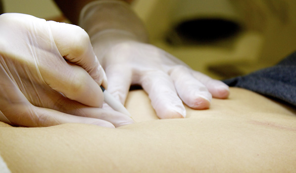 How to find the best hair removal expert